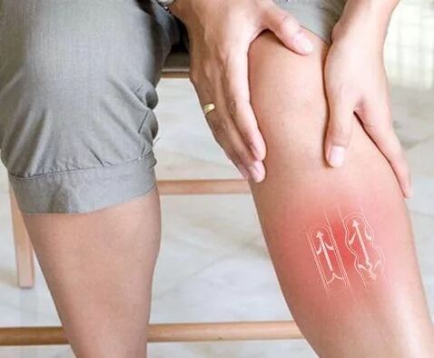 Dysfunction of the venous blood flow to the lower limb