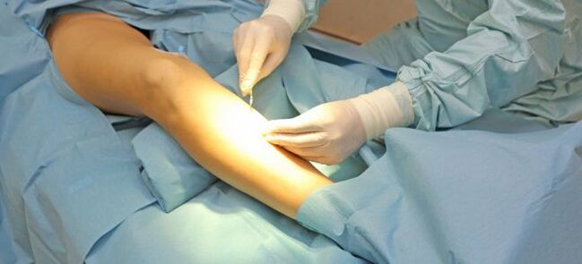 Surgical