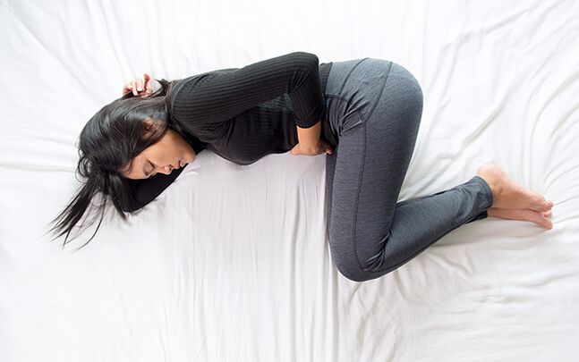 pelvic varicose veins in a woman